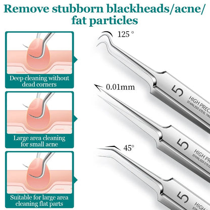 BLACKHEAD REMOVER ACNE TOOL