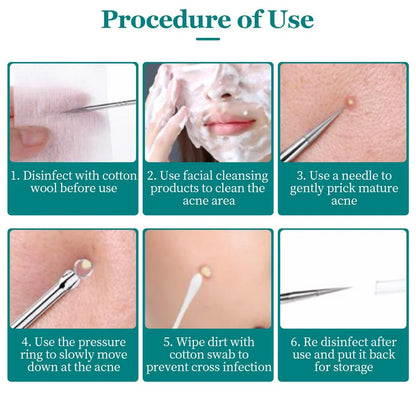 BLACKHEAD REMOVER ACNE TOOL