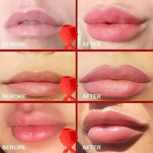 LIP PLUMPER