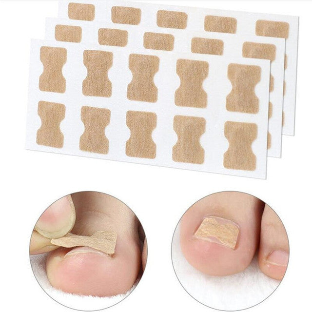 100 PCS Fertoe™ Toenail Corrector Patch