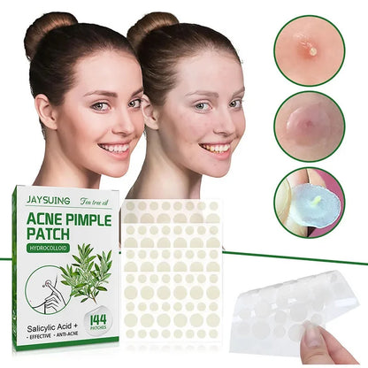 144 Patches Acne Pimple Patch Face Invisible Stickers